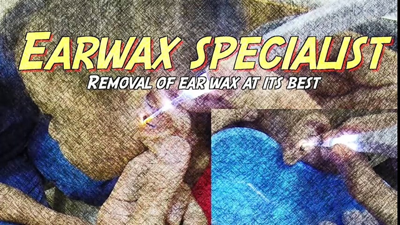 Elderly Woman's Earwax Blockage Causing Tinnitus Removal