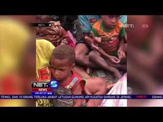 Pemerintah Pusat dan Daerah Berkoordinasi Penanganan Campak dan Gizi Buruk - NET5