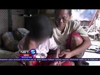 25 Anak Di Banten Menderita Gizi Buruk - NET 5