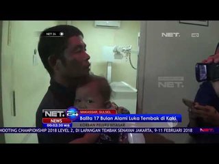 Balita 17 Bulan Alami Luka Tembak Di Kaki - NET 24