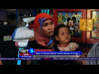 Bayi 13 Bulan Bobot Tubuh Hanya 4,5 Kg - NET 12