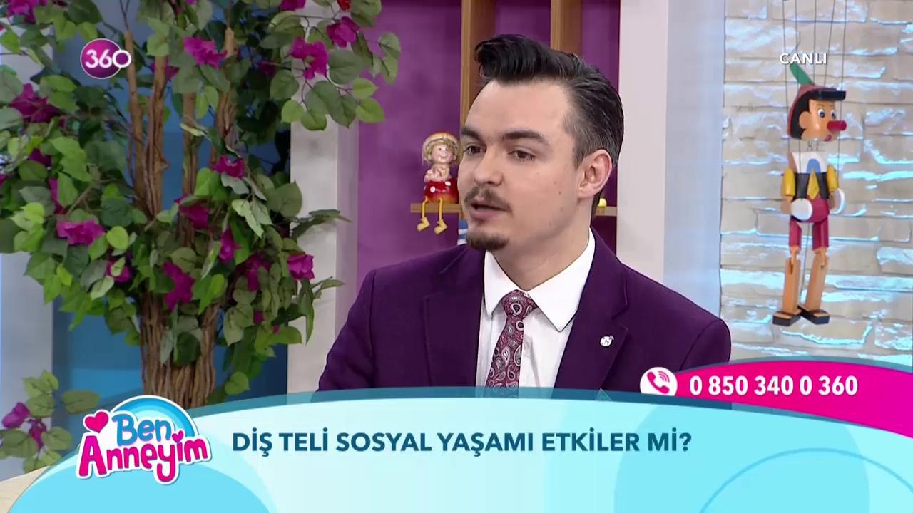 Diş teli sosyal yaşamı etkiler mi?