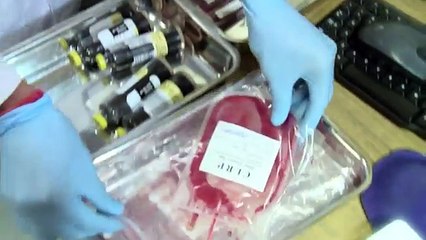 Cord Blood Stem Cell Storage - Cryoviva India