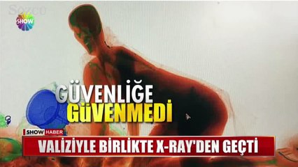 Valiziyle birlikte x-ray cihazından geçti