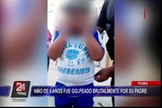 Piura: padre golpea brutalmente a su hijo de ocho años