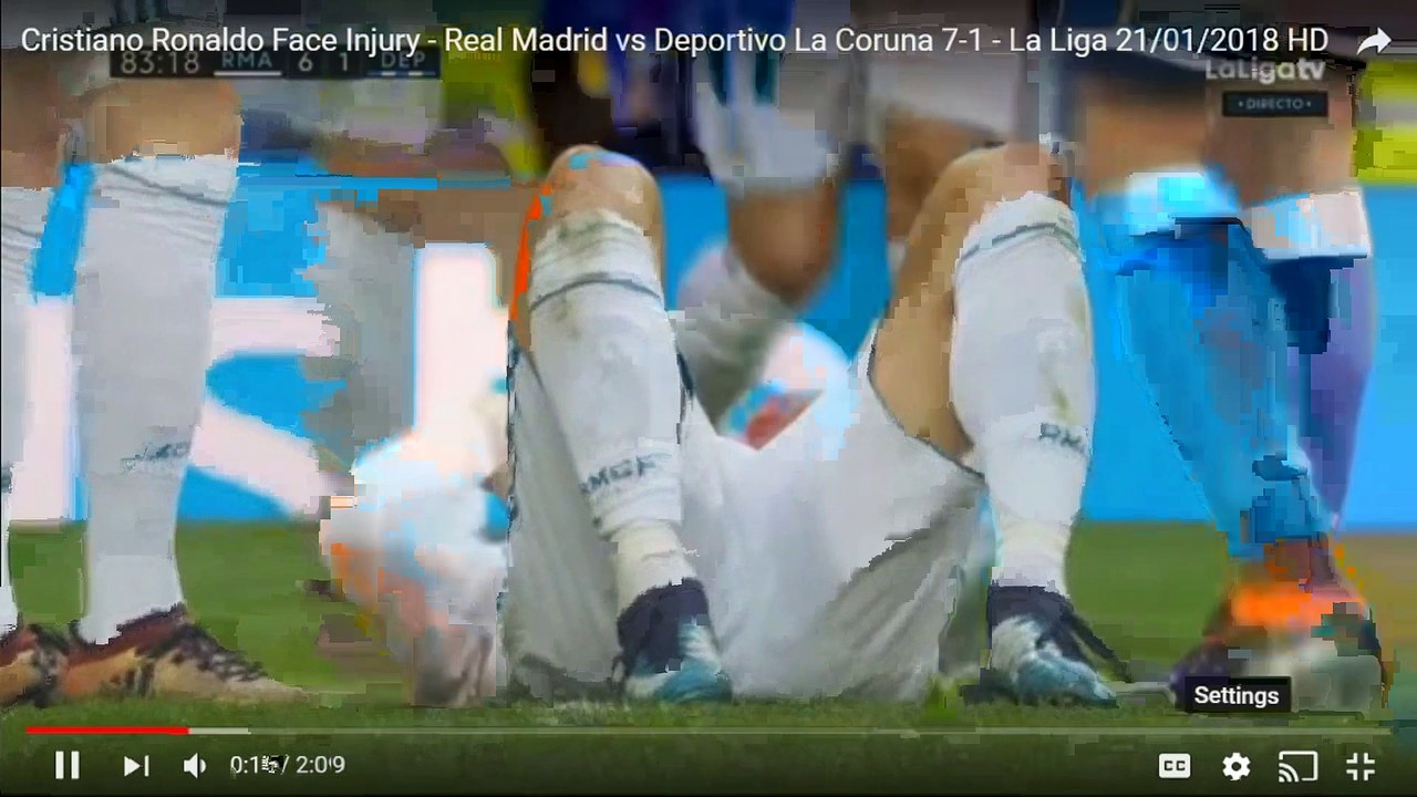 CRISTIANO RONALDO FACE INJURY