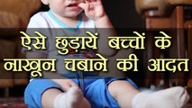 ऐसे छुड़ाएं बच्चों के नाखून चबाने की आदत, Tips to stop kids from chewing nails & fingers | Boldsky