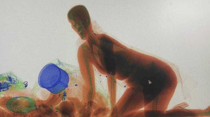 Cette femme s'est accrochée à son sac... jusqu'à l'intérieur d'un scanner à bagages