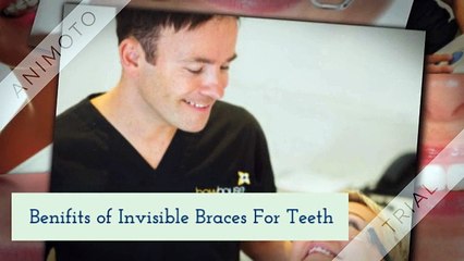Benifits of Invisible Braces For Teeth
