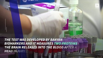 FDA Approves Blood Test That Can Detect Concussions