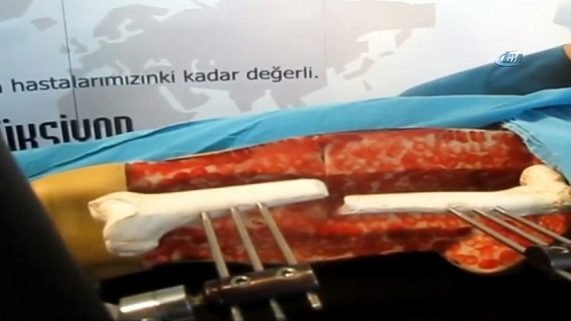 Türk doktordan inanılmaz buluş... 'Doktor robot'