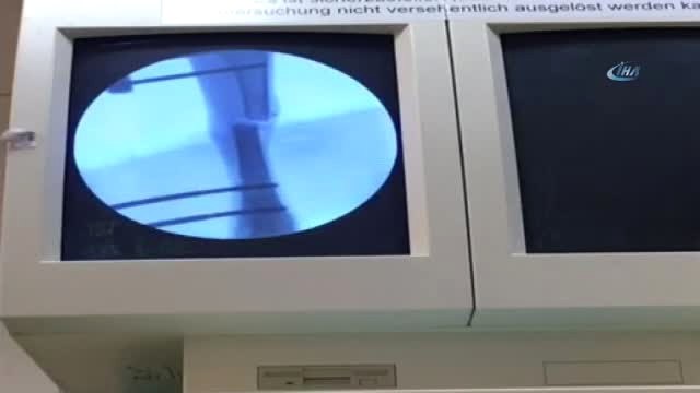 Türk Doktordan İnanılmaz Buluş... Doktor Robot