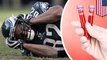 FDA approves new blood test that could help diagnose concussions