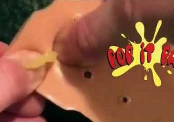 Pimple Popper Toy; Satisfying or Gross?