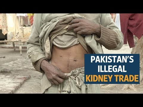 Wealth and poverty propping up Pakistan's illegal kidney trade