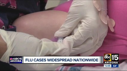 CDC says 84 kids have died from the flu