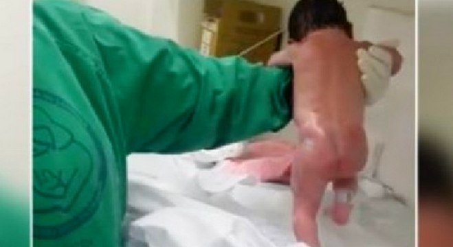A peine née, ce bébé se met à marcher, incroyable !