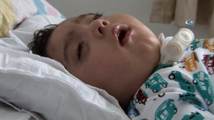 Ömer Ali'nin tek çaresi beyin kök hücre ameliyatı