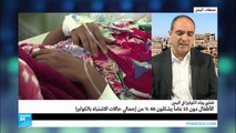 وباء الكوليرا في اليمن.. إصرار أطراف الصراع على مفاقمة الوضع الإنساني