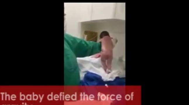 Ce nouveau né se met à marcher alors qu'il vient de sortir du ventre de maman
