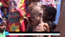 أطفال اليمن يعانون من الجوع وأكثر من 80 بالمئة من السكان بحاجة إلى مساعدات