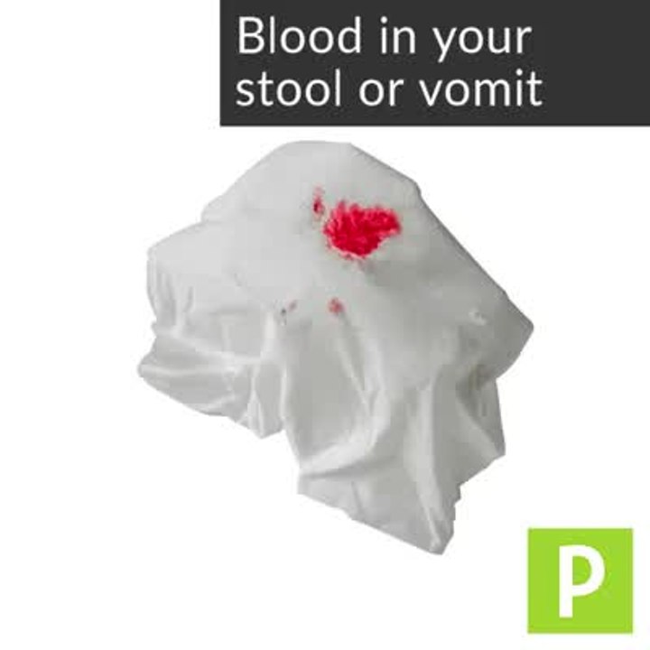 Roughly 1 in 111 adults will develop stomach (gastric) cancer at some point in her lifetime, and the disease is more common among men