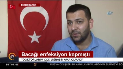 O gazinin bacağı kesilecek