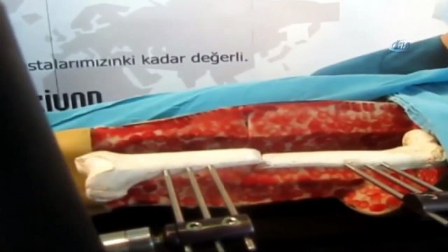 Türk Doktordan İnanılmaz Buluş Doktor Robot