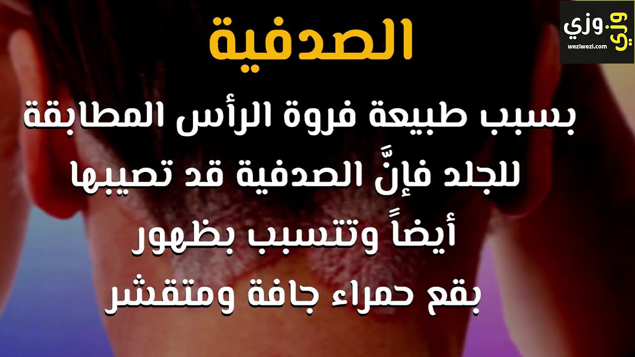 ما هي أمراض فروة الرأس