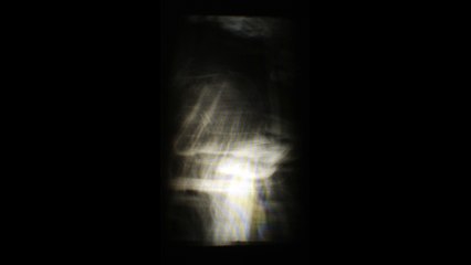 Une Méduse à l'avant plan et un balcon de théâtre à l'arrière plan