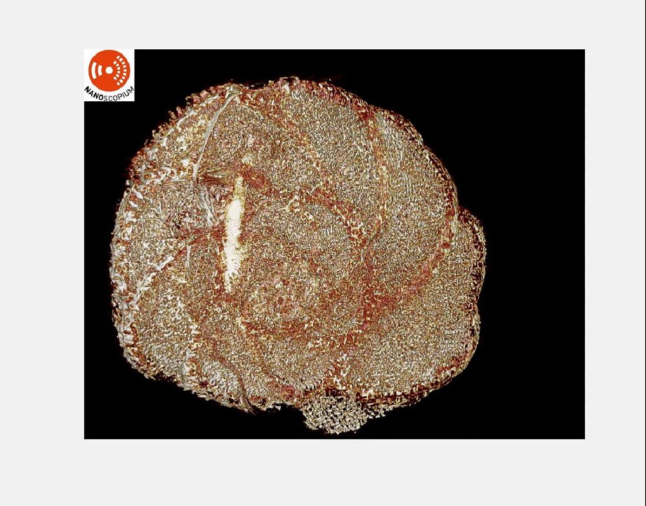 Tomographie X plein champ d'un foraminifère sur NANOSCOPIUM