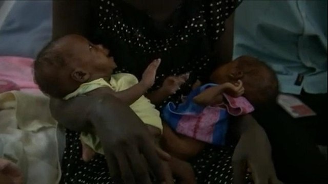 Os riscos dos bebés recém-nascidos