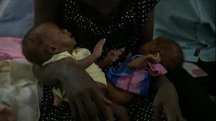 Os riscos dos bebés recém-nascidos