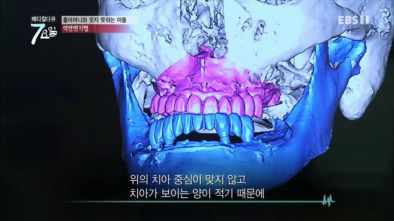 메디컬 다큐 7요일 - 부모를 지키는 삼남매- 다계통 위축증 외_#003