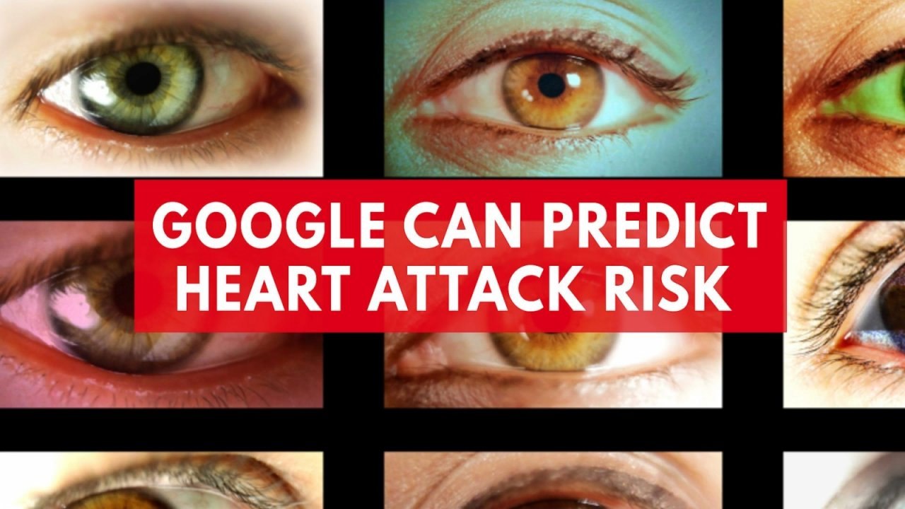 Google retinal scans can predict risk of heart attack
