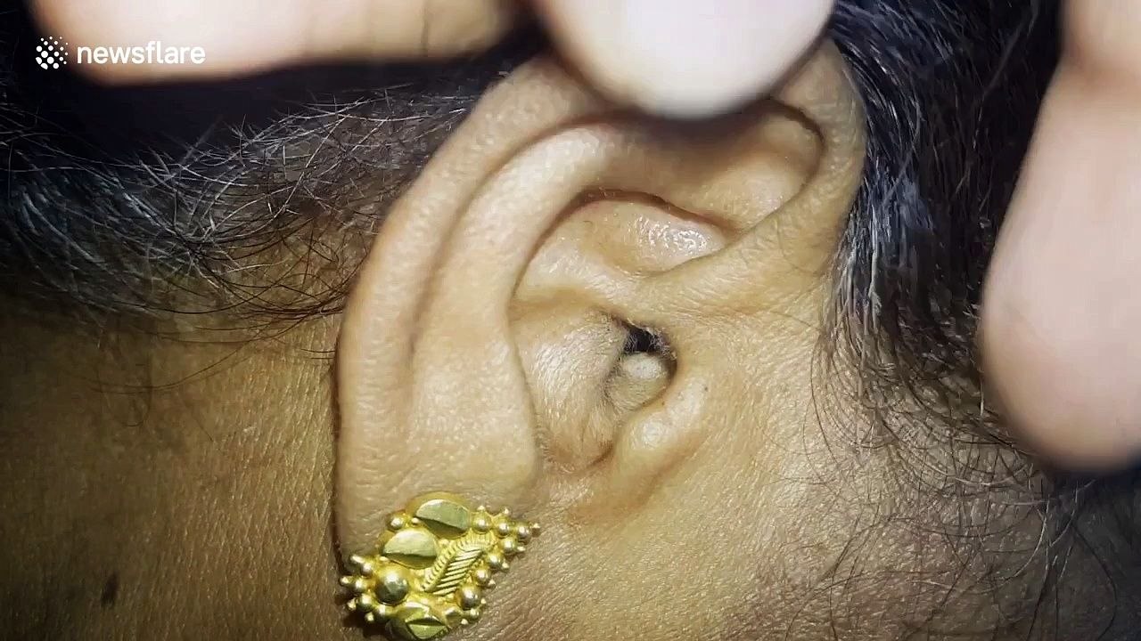 Une araignée dans l'oreille