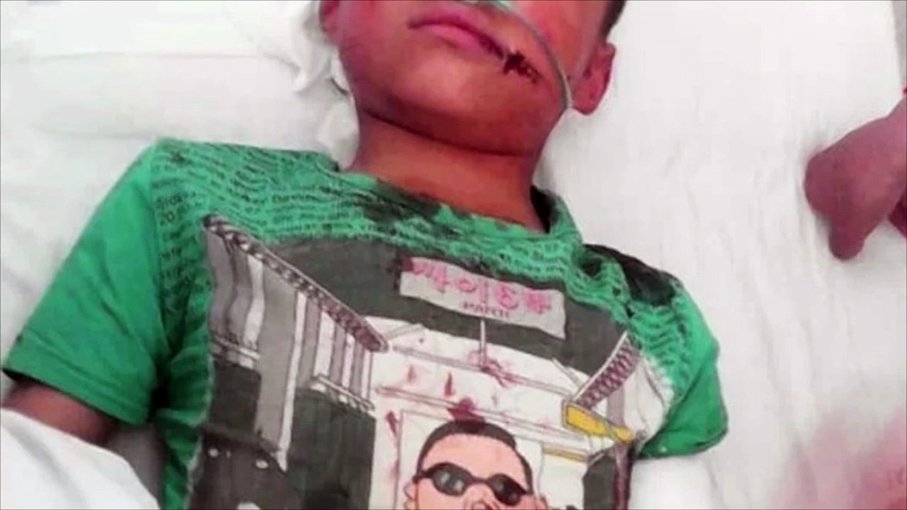 Une belle-mère abuse son beau-fils âgé de 6 ans et le laisse pour à moitié mort