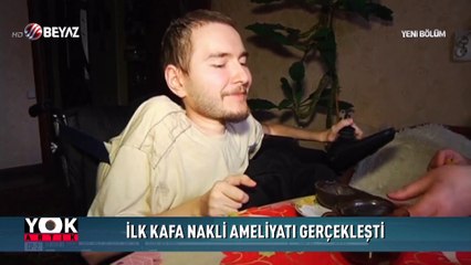İlk kafa nakli ameliyatı gerçekleşti