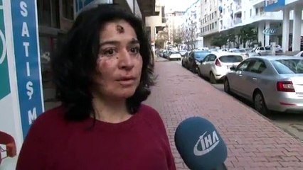 Yüzündeki Yaralar Hayatı Zindan Etti: "Deneylere Katılmak İstiyorum"