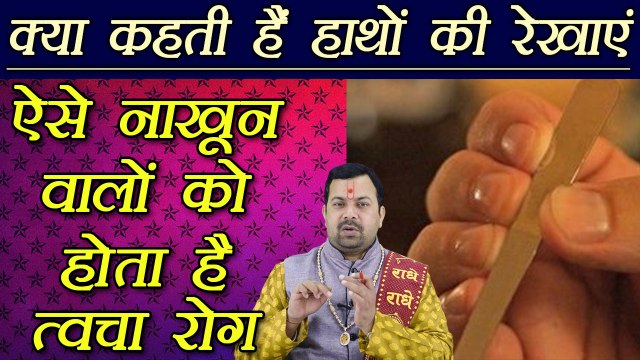 हस्तरेखा: ऐसे नाखून वालों को होता है त्वचा रोग | Palmistry | Palm Lines Reading | Boldsky