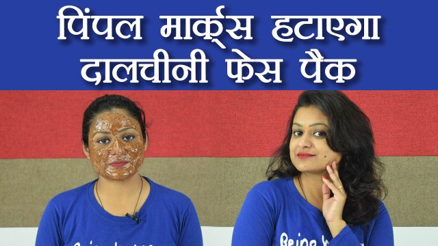 Cinnamon - Honey Face pack for Glowing & Clear Skin | पिंपल मास्क हटाएगा दालचीनी फेस पैक | Boldsky