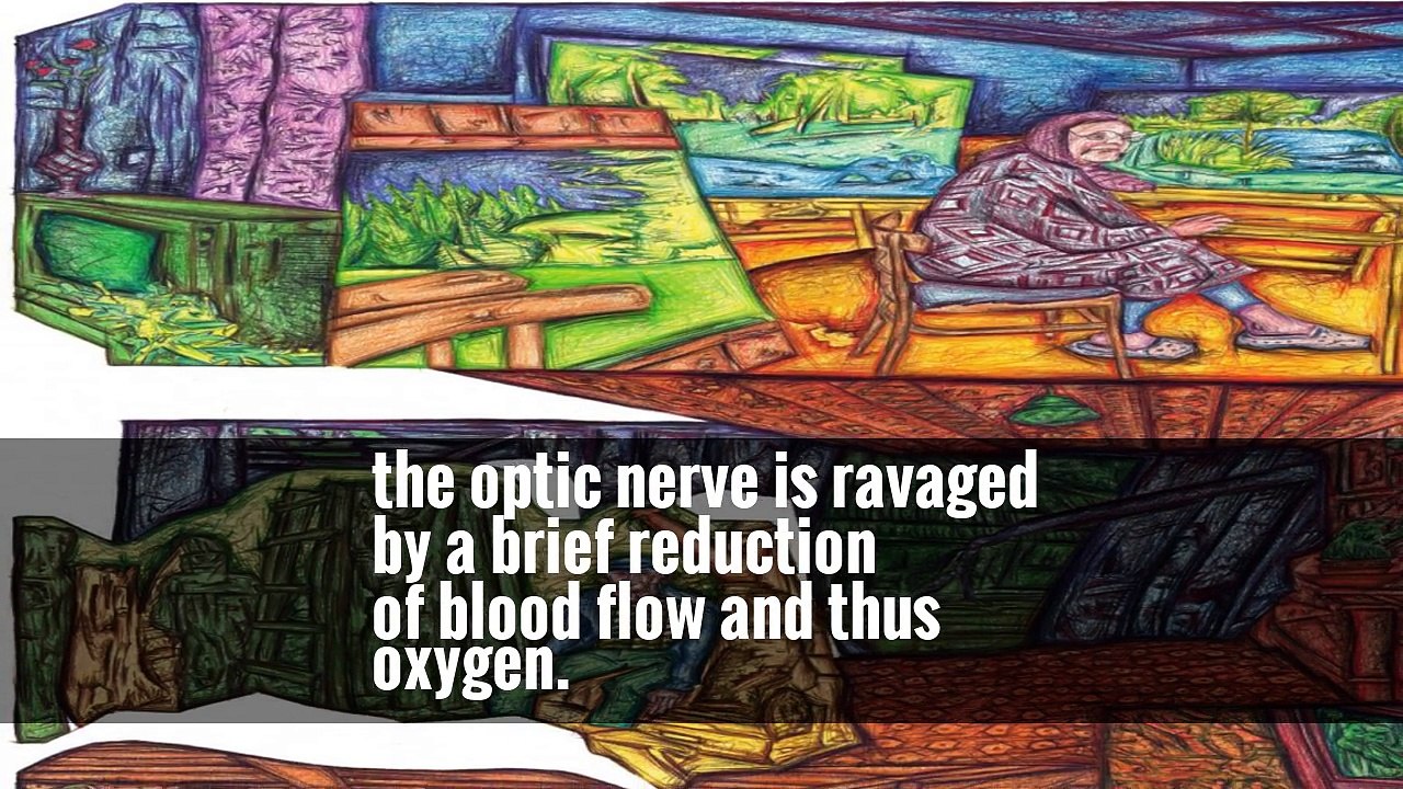 Am I Going Blind? -