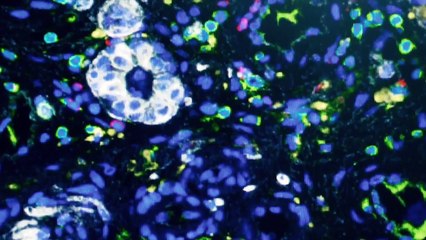 Techknow - Curing Cancer promo