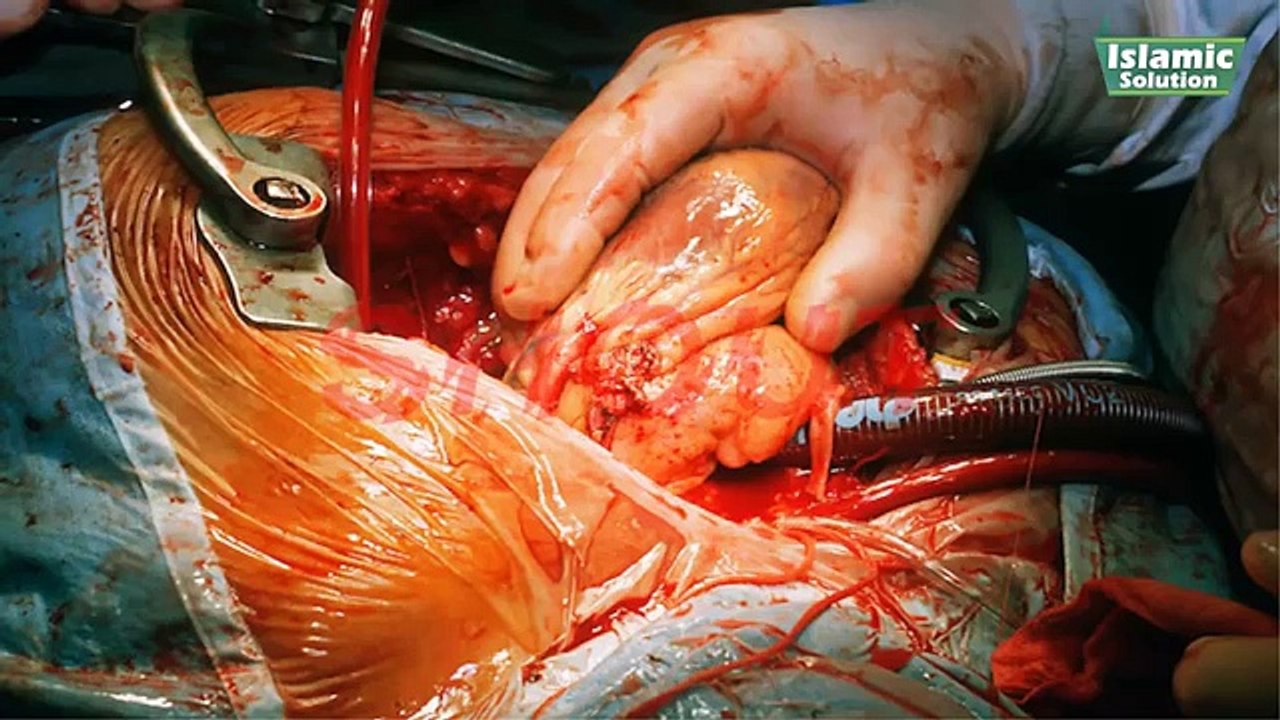 Rooh Jism Kay Kis Hisy Main Hoti Hai - Rooh Scan Krne Wala Camera Ijad - Islamic Solution