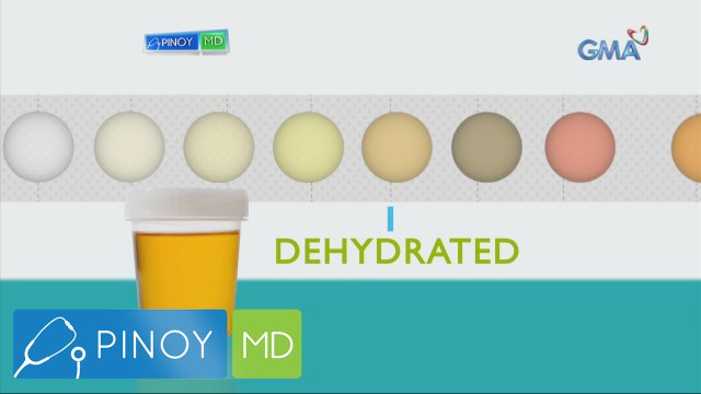 Pinoy MD: Kulay ng ihi, maaaring indikasyon ng karamdaman