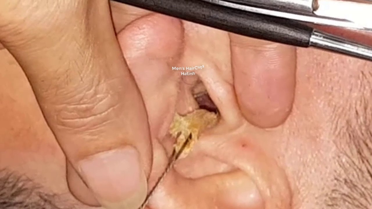 Vietnam ear cleaning #3