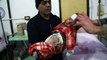 Children treated at Eastern Ghouta clinic after Syrian strikes