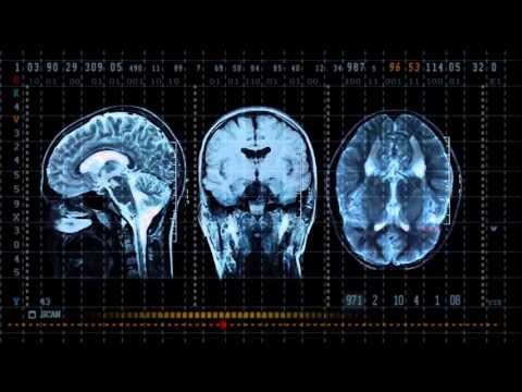 Treating post-traumatic stress disorder | The Economist