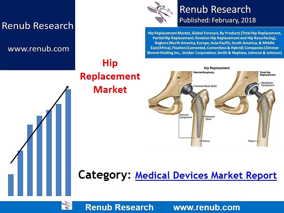 Global Hip Replacement Market