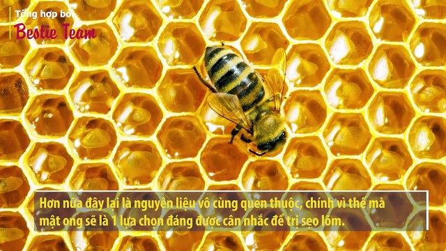 “Đánh tan” nỗi lo sẹo lõm với các bí quyết vô cùng đơn giản mà bạn nên biết